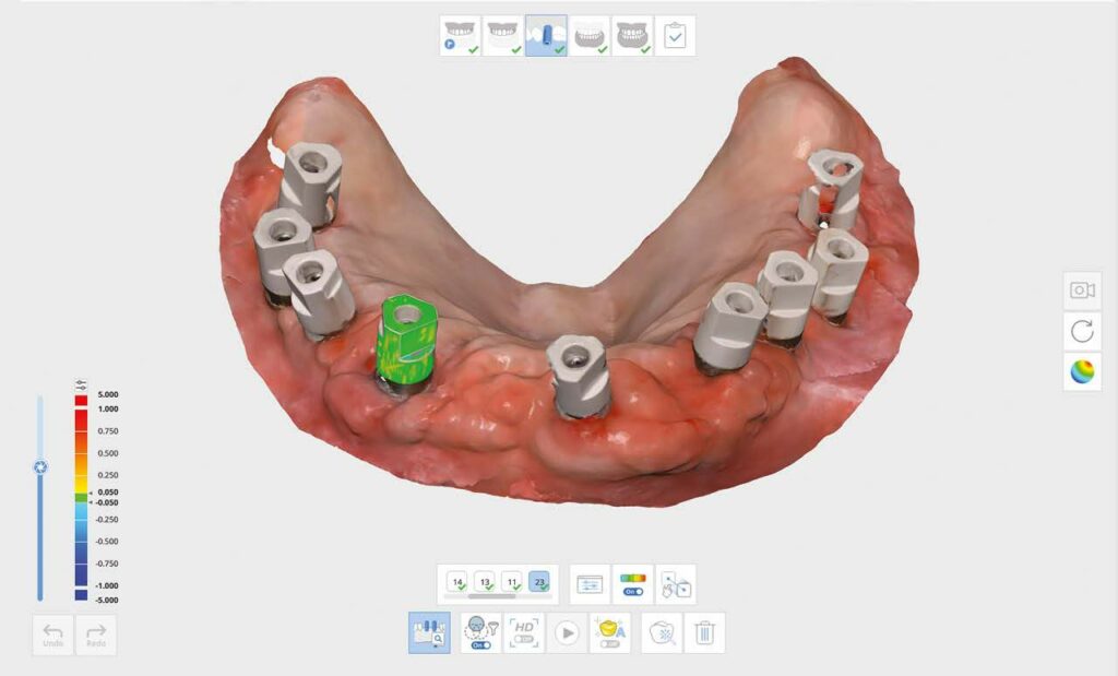 Camera Medit I700 Implant dentaire