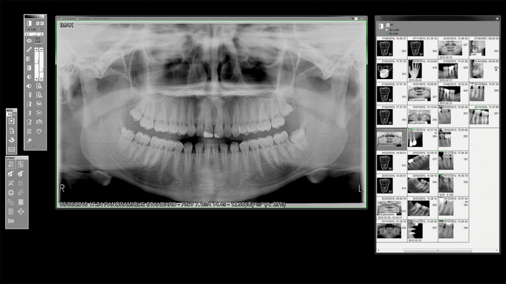QuickVision Logiciel de gestion pour cabinet dentaire visualisation de radiographie dentaire