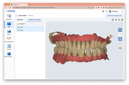 Interface IOS Intra Oral Scanner 04