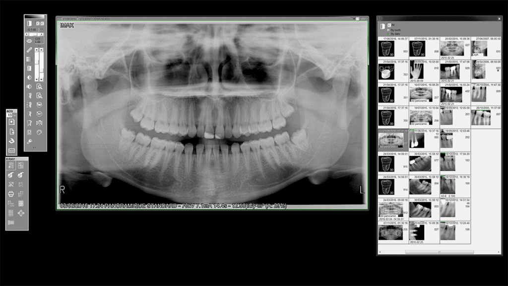 Image interface QuickVision gestion patient