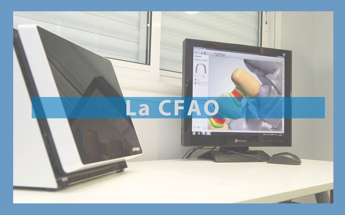 Vig-Cfao